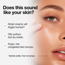 Tải hình ảnh vào trình xem Thư viện, Kem A-Control Azelaic Acid
