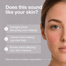 Cargar imagen en el visor de la galería, B-BOOST 22% Niacinamide Serum 30ml