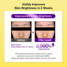 Load image into Gallery viewer, B-BOOST 1% Kojic Acid Toner 200ml