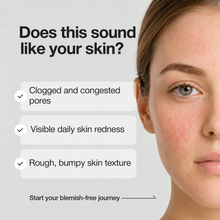 Cargar imagen en el visor de la galería, Tónico de ácido azelaico A-Control 150 ml
